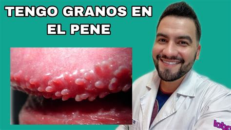 granitos en el oene|Granos en el pene: 10 tipos ofensivos e inofensivos